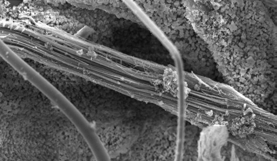 Faser in Raster-Elektronenmikroskop-Aufnahme
